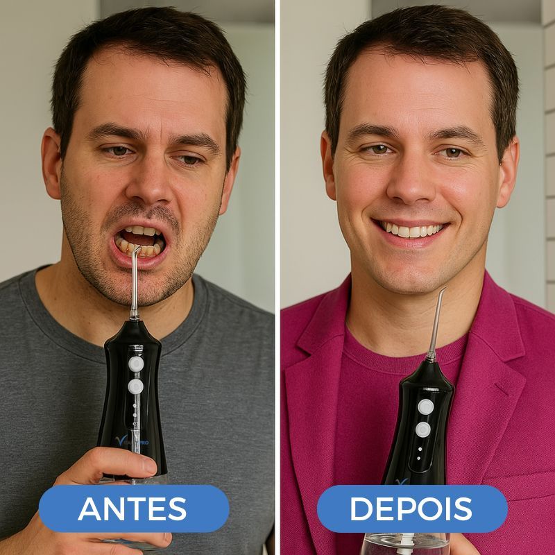 Irrigador-Oral-Limpeza-Profunda-Jato-D_agua-Supersonico_homem