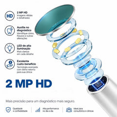 Câmera Intraoral Odontológica IntraView – Câmera Dental HD