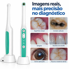 Câmera Intraoral Odontológica IntraView – Câmera Dental HD